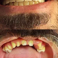 دندانپزشکی در آخونی|خدمات آرایشگری و زیبایی|تبریز, |دیوار