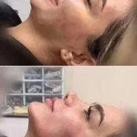 تزریق ژل و بوتاکس|خدمات آرایشگری و زیبایی|اهواز, نادری|دیوار
