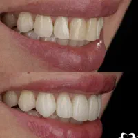 دندان پزشکی اقساطی در اردبیل