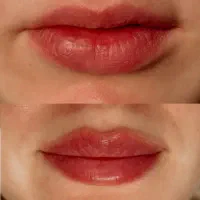 ژل بوتاکس فیلر پی ارپی مزوتراپی خال زگیل کک ومک|خدمات آرایشگری و زیبایی|شیراز, رحمت‌آباد|دیوار