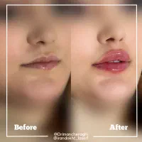جشنواره پاییزی تخفیفات زیبایی توسط پزشک|خدمات آرایشگری و زیبایی|کرمانشاه, |دیوار