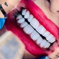 دندانپزشکی و کامپوزیت دندان و دندان مصنوعی