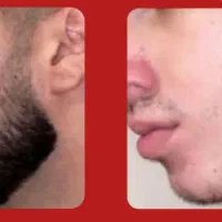 مراقبت نوین ریش