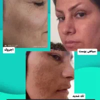 نمایندگی رویال دریاسوج ببرراضی نبودی پس میگیریم|آرایشی، بهداشتی، درمانی|دوگنبدان, |دیوار