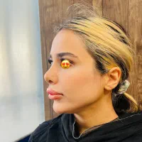 جراحی زیبایی بینی ( عمل بینی )