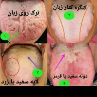طب سنتی مشاوره و زبان شناسی رایگان