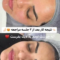پاکسازی پوست فیشال پوست فیشیال پوست|خدمات آرایشگری و زیبایی|تهران, مجیدیه|دیوار