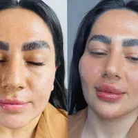 جشنواره باور نکردنی ویژه. ژل و بوتاکس.فیلر مزو ژل|خدمات آرایشگری و زیبایی|شیراز, شریف‌آباد|دیوار