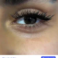 (کاشت هیدن مژه )