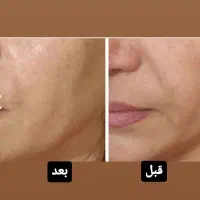 کلینیک پوست و مو|خدمات آرایشگری و زیبایی|تهران, خانی آباد نو شمالی|دیوار
