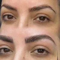 میکرو ابرو فیبروز فقط هزینه مواد