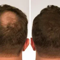 تار های ضعیف رو قوی تر کن