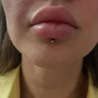 *پیرسینگ‌ چالگونه میکرودرمال*|خدمات آرایشگری و زیبایی|اهواز, نادری|دیوار