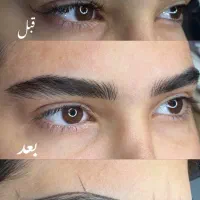 تخفیف استثنایی میکروبلیدینگ ابرو