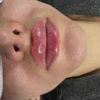 مرکز تخصصی تزریق بوتاکس فیلر لیزر موهای زاید هایفو|خدمات زیبایی و سلامت|تبریز, |دیوار