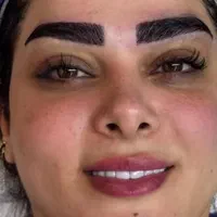 کاشت تخصصی مو سه بعدی و ابرو در خانه ی کاشت|خدمات آرایشگری و زیبایی|مشهد, احمدآباد|دیوار