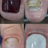 خدمات تخصصی ناخن و پدیکور|خدمات آرایشگری و زیبایی|تهران, یوسف‌آباد|دیوار
