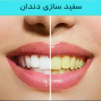 دندانپزشکی اقساطی(ارتودنسی بدون پول پیش)دندان|خدمات آرایشگری و زیبایی|مشهد, وکیل‌آباد|دیوار