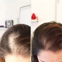 هزینه کمتر رویش بیشتر