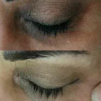 اولین درمانگرلک با متدپکینگ آپ وحذف تک جلسه کک مک|خدمات آرایشگری و زیبایی|بوشهر, |دیوار