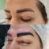 کاشت ابرو دائمی/جراحی پلک(بلفاروپلاستی)|خدمات آرایشگری و زیبایی|تهران, پونک|دیوار