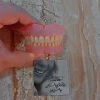 دندانسازی الماس