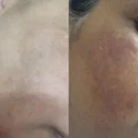 فرمول کرم