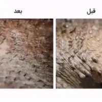 درمان گیاهی زگیل و تبخال مشاوره رایگان|آرایشی، بهداشتی، درمانی|تهران, سعادت‌آباد|دیوار