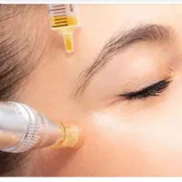 جوانسازی ضدلک صورت،قطع ریزش مو،پی آر پی،مزو ،آر اف