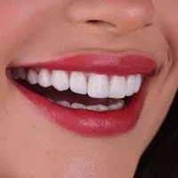 درمانگاه دندانپزشکی/کف قیمتی/طرف قراردادبیمه ها|خدمات زیبایی و سلامت|شیراز, عفیفآباد|دیوار