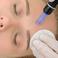 انواع وسایل وابزارمزو