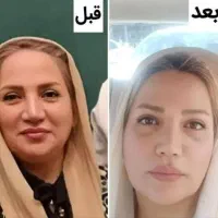 کرم پاورلیفتینگ (ماساژوردار)وسرم بوتاکس|آرایشی، بهداشتی، درمانی|کرمان, |دیوار