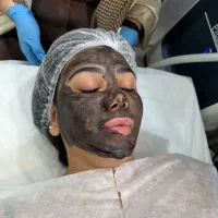 ریمو تتو ابرو بدن خط چشم کربن تراپی لک