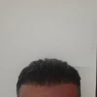 کلینیک تخصصی کاشت مو و ابرو ایرانیان