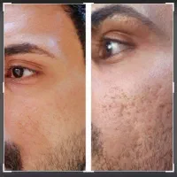 پوستتو عین آینه شفاف کن