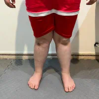 درمان بدون جراحی مشکلات ارتوپدی