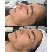 پاکسازی پوست/فشیال تخصصی|خدمات آرایشگری و زیبایی|شیراز, شهرک فرزانگان|دیوار