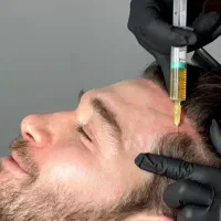 پی ار پی موی سر