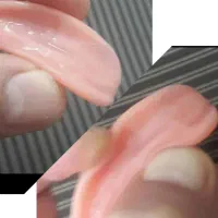 ژله ای کردن دندان مصنوعی که اذیت میکند ۳ ساعته