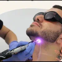 جشنواره لیزر رایگان فقط تا پنج شنبه/تضمینی/ لاله|خدمات آرایشگری و زیبایی|اصفهان, باتون|دیوار