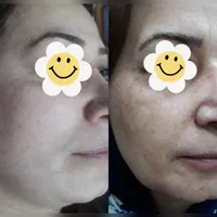 کرم ضدلک گلدن شاین ضد لک روشن کننده سفیدکننده|آرایشی، بهداشتی، درمانی|شیراز, احمدی جنوبی|دیوار