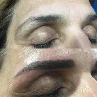 فصل ریموو شروع شد.