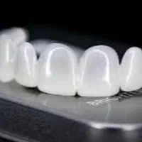 لمینت متحرک دندان|آرایشی، بهداشتی، درمانی|سنندج, |دیوار