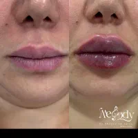 جشنواره ی زمستانه به مدت محدود