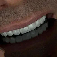 خدمات فوق تخصصی  دندانپزشکی کلینیک پالادیوم|خدمات آرایشگری و زیبایی|شیراز, معالی‌آباد|دیوار