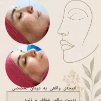 فیشیال و پاکسازی پوست|خدمات آرایشگری و زیبایی|اهواز, رسالت|دیوار