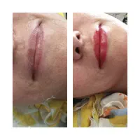 میکروبلیدینگ تغییررنگ تیره به روشن  وبوتاکس۴۵۰|خدمات آرایشگری و زیبایی|رشت, باهنر|دیوار