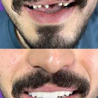 دندانپزشکی سپید|خدمات آرایشگری و زیبایی|تبریز, |دیوار