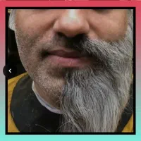 کف دستت هم بزنی مو درمیاد