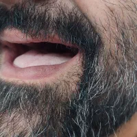 دندان کامل و اقساط